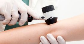 Queensland Skin Cancer Costs Highlight Need for Stronger Prevention