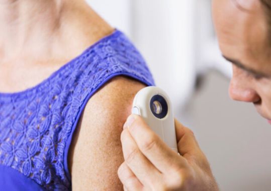 Could AI help doctors better detect melanoma?