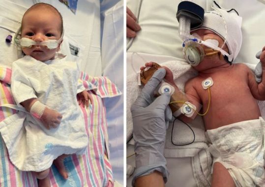 Call for RSV vaccine clarity