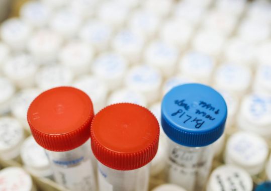 GPs are key to the adoption of DNA screening