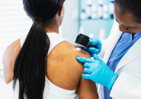 Study shows link between equity and melanoma care