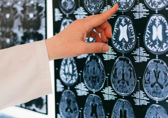 BUILDS Program improves stroke care access in North West Tasmania