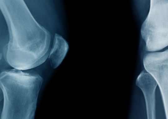 Changes to Diagnostic Imaging Reports in My Health Record