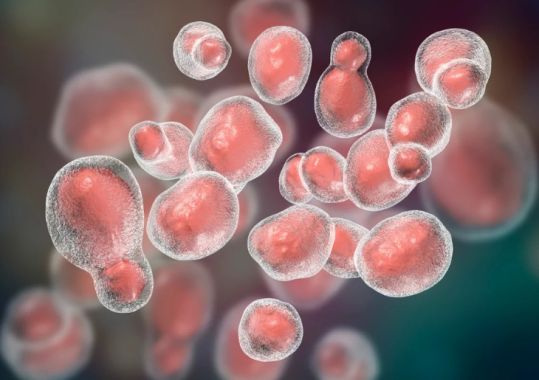 Report Released on Fungal Outbreak at RPA Hospital