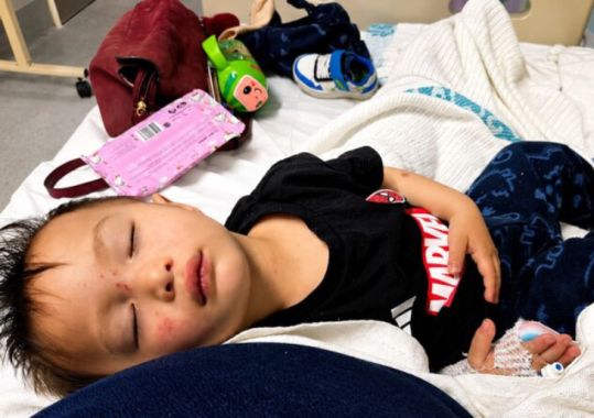 Experts urge national action on infant RSV protection