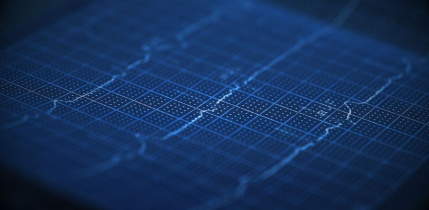 AMA calls for GP rebates for ECGs to be restored