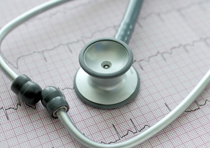 Preventive care for atrial fibrillation currently ‘less than ideal’